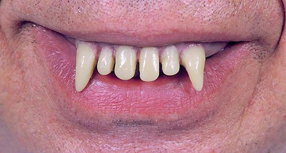Ghoulio Wacky Glow Teeth Adult Costume Accessory